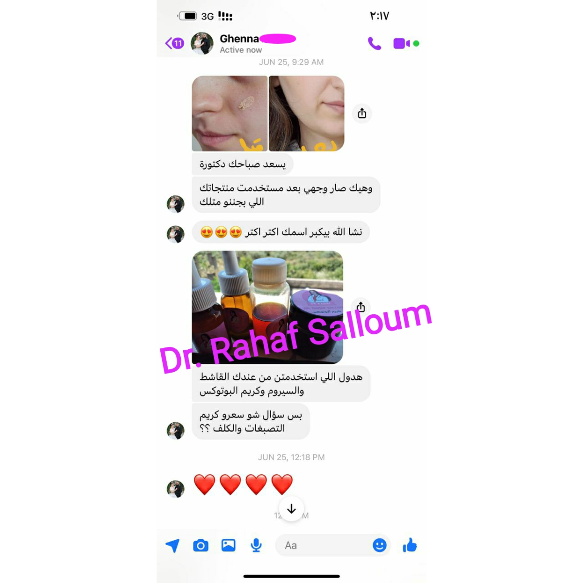 product img