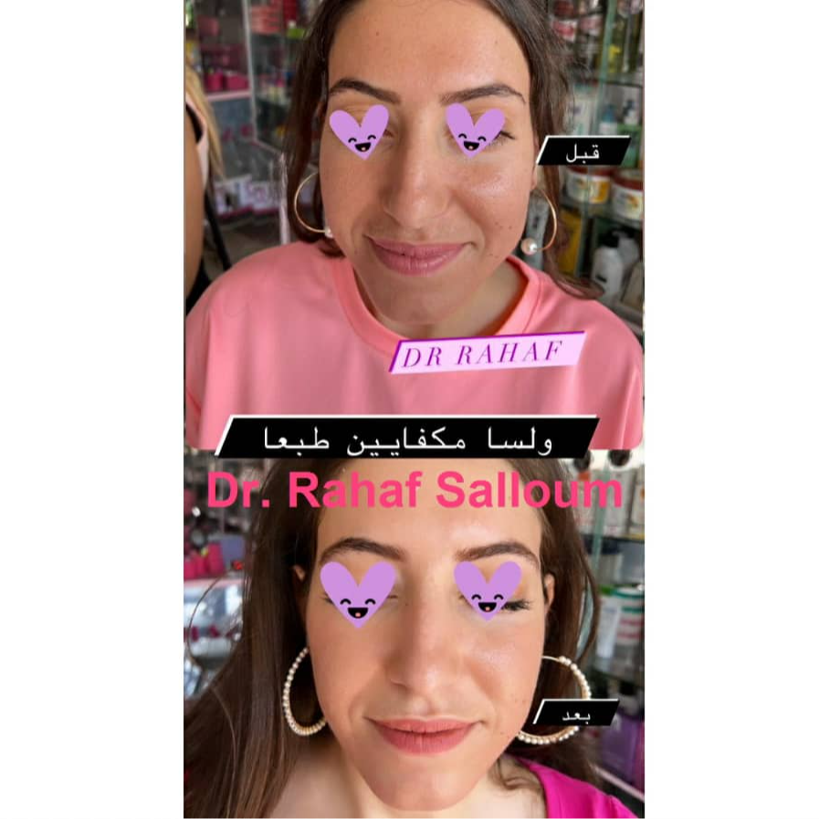 product img