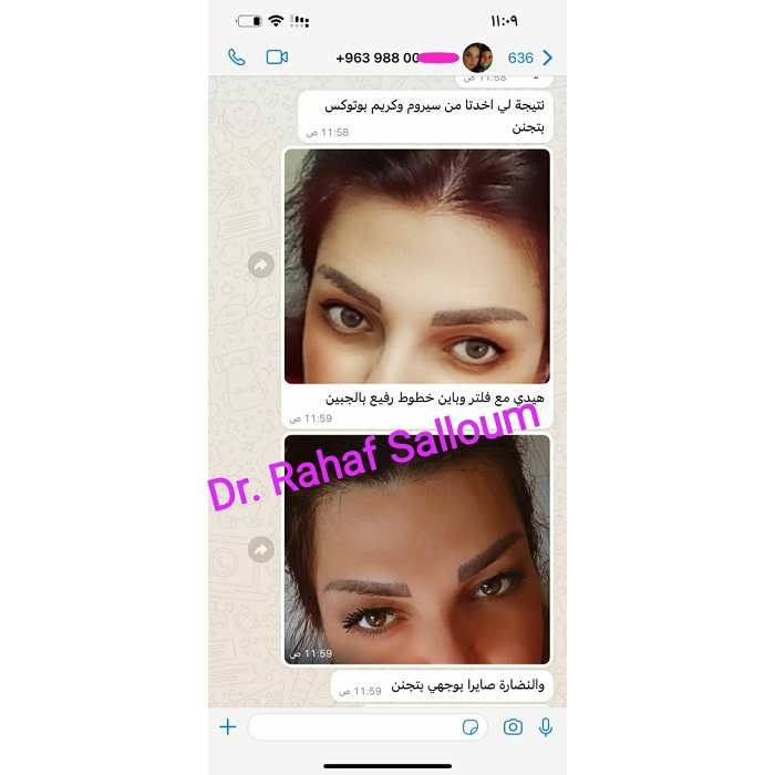 product img