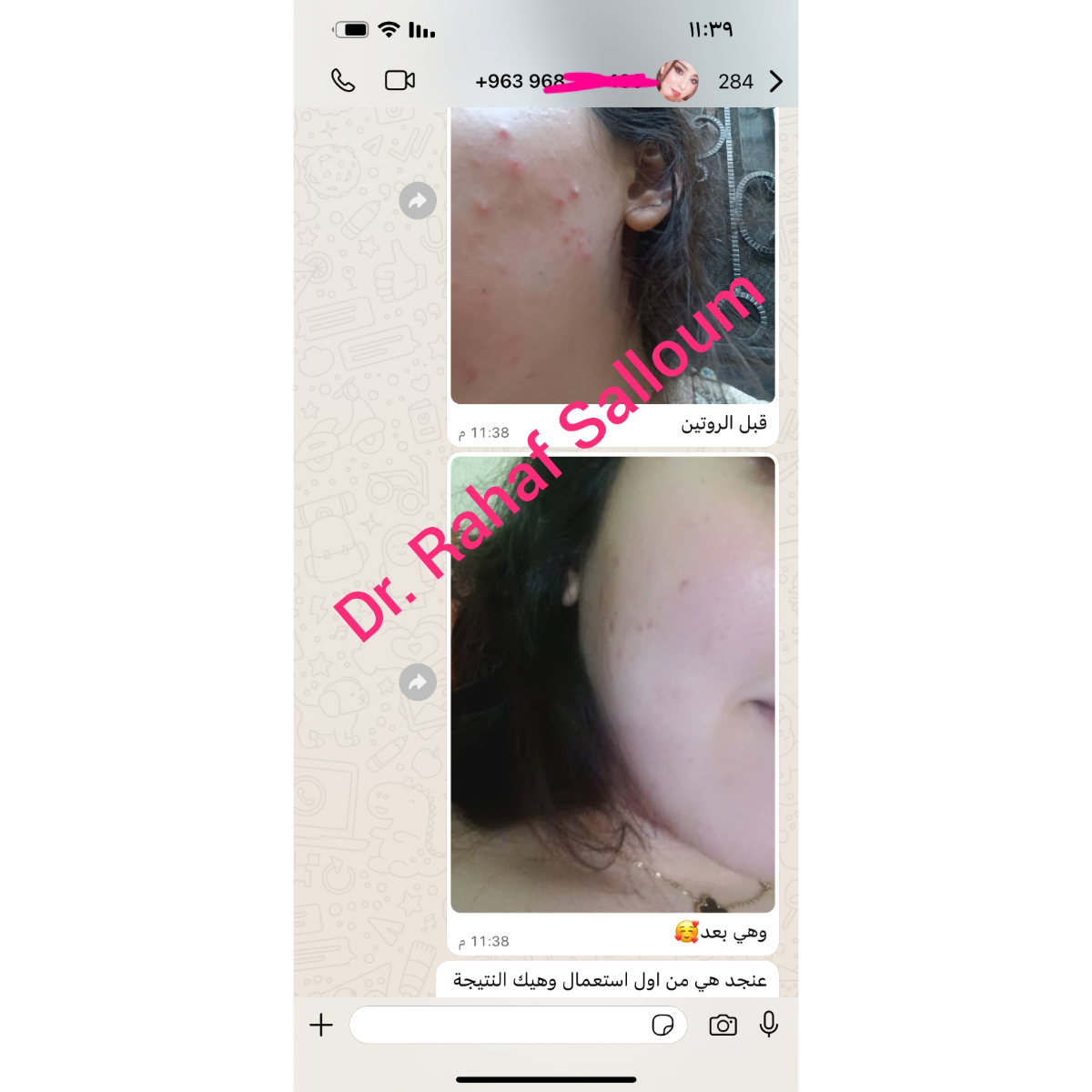 product img
